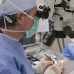 Cataract Surgery